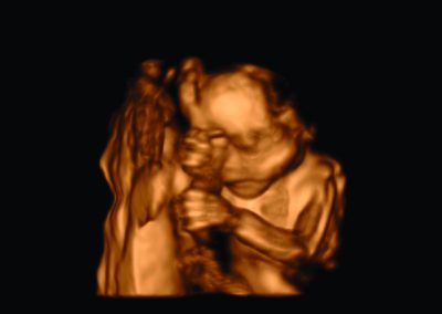 Fetus in 3D