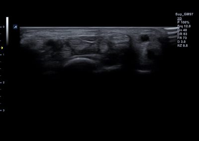 Superficial area of wrist in 2D 8
