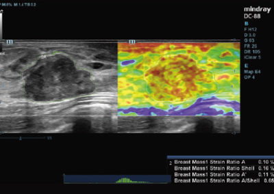 Natural Touch Elastography